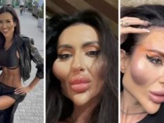 Žena s najvećim obrazima na svijetu objavila fotografiju iz mladosti